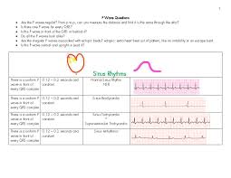 Ekg P Wave Chart Student Nurse Laura