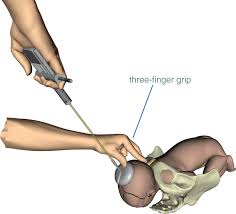 Image result for Vacuum Caput