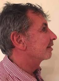 14_Cirugia plastica revista 20200203.indd