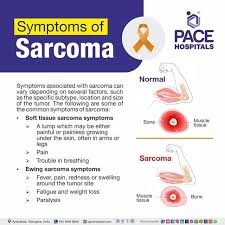 Image result for Sarcoma