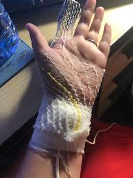 L'apnée du sommeil se manifeste suite à une obstruction au niveau des voies respiratoires durant le sommeil. L Apnee Du Sommeil Forum Depression