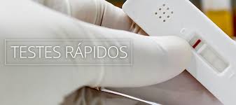 It does not test for immunity or if you had the virus in the past. Ambulatorio De Infectologia De Ubatuba Oferece Autoteste Gratuito Para Hiv Prefeitura Municipal De Ubatuba