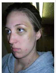 Standing Up To Abuse