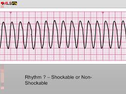 Which rhythms are shockable never forget with this shockable rhythms rap. Als Ppt Video Online Download