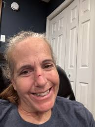 These are my very own death stairs . I have quite bad osteoarthritis and  getting upstairs has become difficult. So one day the nice OT chap came and  fitted me another hand