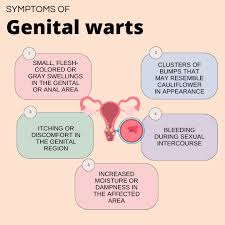 Image result for genital warts