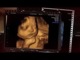 Video Cutie Babies 3d 4d Scan Baby Scan Cutie Video