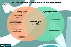 Overview Of Constipation In Hypothyroidism