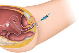 I was just wondering how many of you do home pregnancy tests before your beta testing ? Intrauterine Insemination Iui Obstetrics Gynecology Of Atlanta