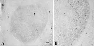 Listen to daniel cersosimo ex arquero de velez velez radio by eco medios | entrevistas for free. Red Nucleus Structure And Function From Anatomy To Clinical Neurosciences Springerlink