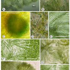 Image result for Crepidorhopalon goetzei