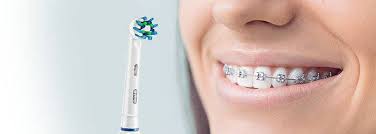 This is when you'll find out if you have any broken or bent braces and when you can get them repaired. How To Brush Your Teeth And Floss With Braces Oral B