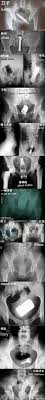 Shop the top 25 most popular 1 at the best prices! The Most Ridiculous Things That Are Stuck In The Anus Buzz Lightyear Damn You Human 9gag