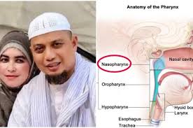 Obat sakit telinga di apotik baik bernanah, berair, gatal, dan kotor. Gejala Awal Kanker Nasofaring Selain Telinga Berdengung Adalah Hidung Tersumbat Seperti Yang Diderita Almarhum Ustaz Arifin Ilham Semua Halaman Grid Health