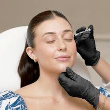 Sculptra Injections