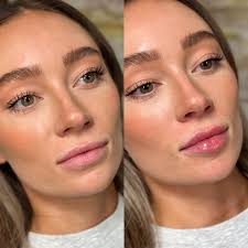 Emily Epley, MSN, FNP-C 💉