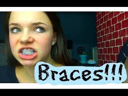 Braces