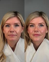 Ellen Elizabeth Aesthetics...