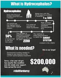 Hydrocephalus Infographic Awareness Traumatic Brain Injury Brain Facts