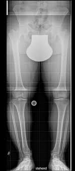 If you have bcbs insurance, finding a rehab center shouldn't be too. Is Contact Shielding During X Rays Ct Scans Obsolete Healthcare In Europe Com