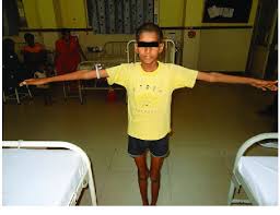 Image result for Arm Span