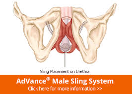 Dr Gerard Henry M D Worldwide Urologist Expert Treatment Options