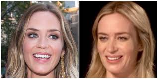Emily Blunt's Teeth: Are They Fake?