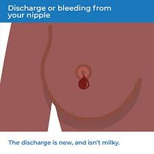 However, there are early warning signs that do overlap among the different cancer before we get into the detailed symptoms for each type of cancer, here are the general symptoms that they share: Breast Cancer Symptoms Health Information Bupa Uk