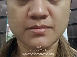 Cirujano Oral, Estética y Armonización