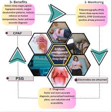 Image result for Obstructive Sleep Apnea