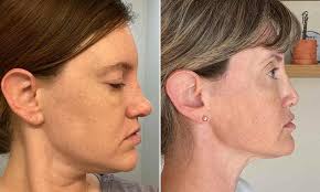 Former soldier, 42, asked his mother to help kill him after become  completely paralysed from a stoke