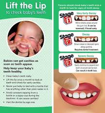 A Great Way To Keep A Check On Your Child S Teeth To Make Sure They Aren T On Their Way To Developing Cavities Lift The Li Dental Decay Dental Kids Dental
