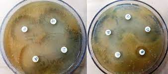Storage conditions and shelf life: Antibiotic Susceptibility Testing In Mueller Hinton Agar For Download Scientific Diagram