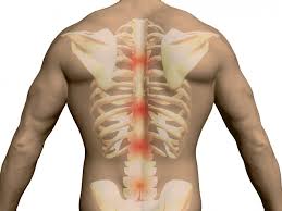 An uneven rib cage means the two sides of the rib cage are not symmetrical. Thoracic Spine