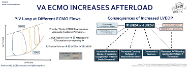Image result for Afterload