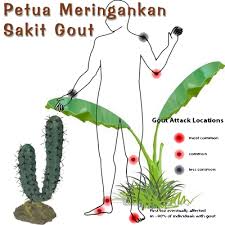 Mungkin 9 petua hilangkan gegata ini berguna untuk anda. Petua Hilangkan Gout Archives Wirahot