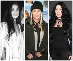 May 20, 1946) is an american singer, actress and television personality. Cher S Plastic Surgery See Her Transformation Over The Years