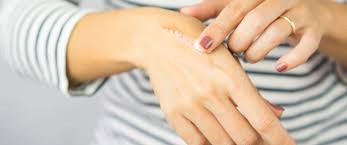 مراحل شفاء الحروق ونصائح لشفاء سريع ويب طب