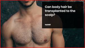 Maybe you would like to learn more about one of these? Body To Scalp Hair Transplant How Effective Successful