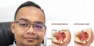 Sakit tumit ni jangan buat main² kadang nak berjalan pun susah. Punca Peranakan Jatuh Archives Mingguan Wanita