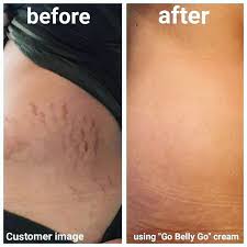 3 Enfants Pas De Vergetures Grandir Bebe Etsy Organic Body Butter Stretch Marks Treating Dry Skin