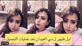 بدورها، لم تتمكن الاعلامية مي العيدان من تجاهل هذا الأمر، حيث نشرت المقطع مع إشارة الى حركة وجه تامر وعلقت عليه: ØµÙˆØ±Ø© Ù‚Ø¯ÙŠÙ…Ø© Ù„ Ù…ÙŠ Ø§Ù„Ø¹ÙŠØ¯Ø§Ù† Ù…Ù† Ø´Ù‡Ø± Ø¹Ø³Ù„Ù‡Ø§ ØªÙƒØ´Ù ÙƒÙŠÙ ÙƒØ§Ù† Ø´ÙƒÙ„Ù‡Ø§ Ø§Ù„Ù‰ ÙƒÙ… Ø¹Ù…Ù„ÙŠØ© ØªØ¬Ù…ÙŠÙ„ Ø®Ø¶Ø¹Øª Youtube