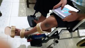 Waktu tidur yang tidak cukup dan tidak teratur akan menyebabkan sakit kepala yang terus menerus hingga hal ini diperbaiki. Aveo Sepatu Pencegah Kekakuan Pergelangan Kaki Penderita Kelumpuhan Universitas Gadjah Mada