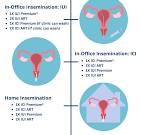 Sperm Vial Type and Specimen Information | Fairfax Cryobank