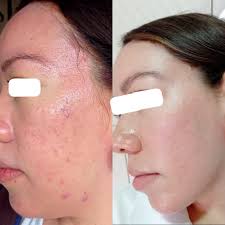 Dermatóloga Dra. Sonia...