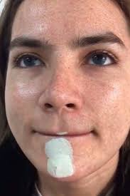 The Secret to Gorgeous, Glowing Skin? Not Botox