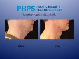 There are reasons for the biological difference between males and females in the likelihood of having a visible. Get Your Adam S Apple Back Video Buildmybod Health