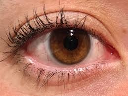 Image result for Presbyopia