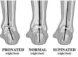 Strengthen Your Ankles Feet To Improve Performance Prevent Injuries Plantar Fasciitis Shin Splints What Is Plantar Fasciitis
