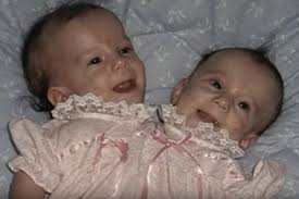 Brittany (left) and abby driving their car in a clip from their reality showcredit: Inside The Life Of Conjoined Twins Abby And Brittany Hensel